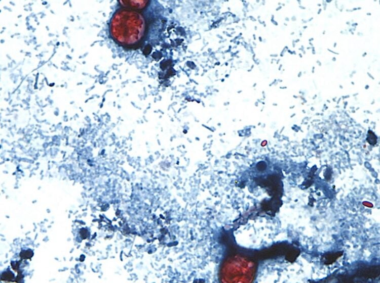 A view of a stool sample seen through a microscope with a parasite present.